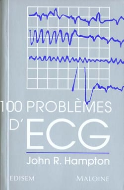 100 problemes d'ecg
