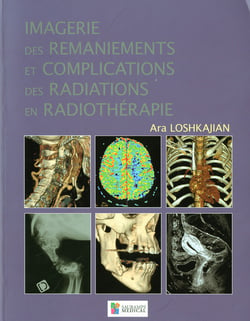 Imagerie des ramaniements et complications des radiations en radiothérapie