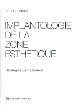 Implantologie de la zone esthétique - stratégies de traitement