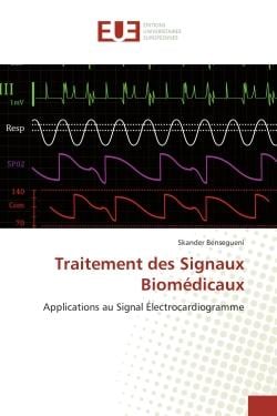 Traitement des Signaux Biomédicaux : Applications au Signal Électrocardiogramme
