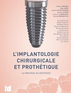 L'implantologie chirurgicale et prothétique - la pratique au quotidien
