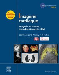 Imagerie cardiaque - imagerie en coupes : scanner, IRM