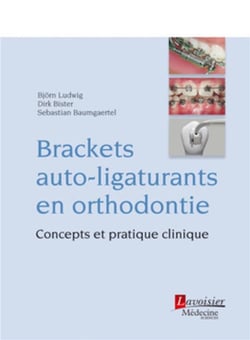 Brackets auto-ligaturants en orthodontie - concepts et pratique clinique