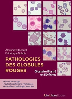 Pathologies des globules rouges : Glossaire illustré en 50 fiches