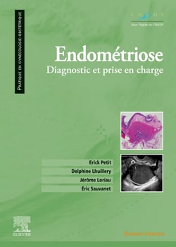 Endométriose - diagnostic et prise en charge