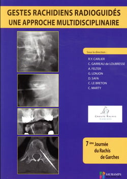 Gestes rachidiens radioguides - une approche