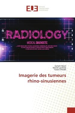Imagerie des tumeurs rhino-sinusiennes