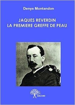 Jacques reverdin - la première greffe de peau