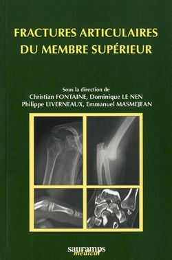 Fractures articulaires du membre supérieur
