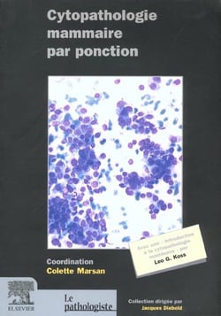 Cythopathologie des lesions du sein