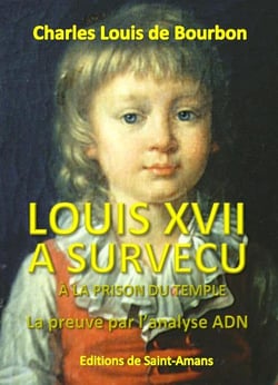 Louis Xvii A Survecu A La Prison Du Temple  La Preuve Par L'Analyse Adn