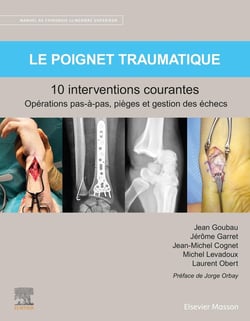 Le poignet traumatique, 10 interventions courantes : manuel de chirurgie du membre supérieur