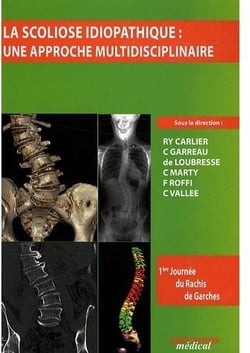 La scoliose idiopathique - une approche multidisciplinaire