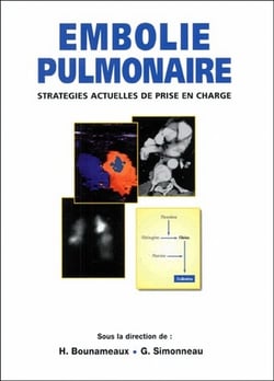 Embolie pulmonaire