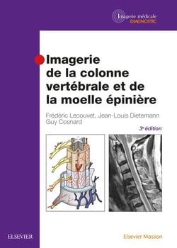 Imagerie de la colonne vertébrale et de la moelle épinière (3e édition)