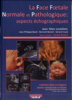 La face foetale normale et pathologique: aspects échographiques