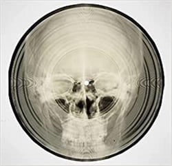 Bone music: soviet x-ray audio