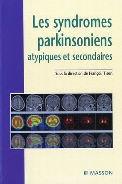 Les syndromes parkinsoniens