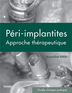 Péri-implantites - approche thérapeutique - guide clinique pratique