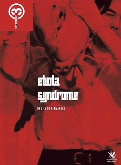 Ebola Syndrome