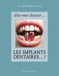 Dites-moi docteur... les implants dentaires... ?