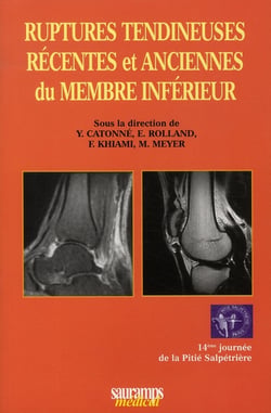 Ruptures tendineuses récentes et anciennes du membre inférieur