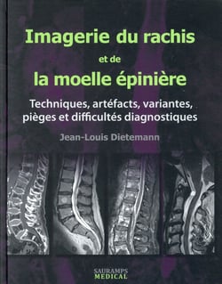 Imagerie du rachis et de la moelle épinière - techniques, artefacts, variantes, pièges et difficultés diagnostiques