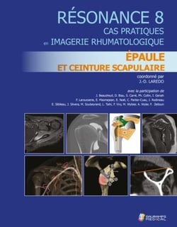 Résonance 8 : épaule et ceinture scrapulaire : cas pratique imagerie rhumatologique