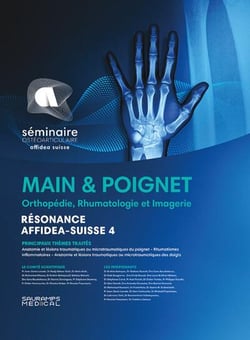 Résonance diagnostic en imagerie rhumatologique : Main & poignet : Orthopédie, rhumatologie - imagerie - résonance Affidea Suisse 4