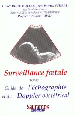 Surveillance foetale doppler tome 2 - vol02