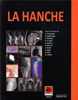 La hanche - sims 2019