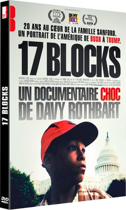 17 Blocks