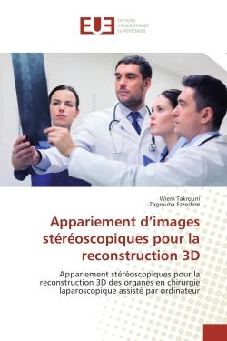 Appariement d'images stereoscopiques pour la reconstruction 3D : Appariement stèreoscopiques pour la reconstruction 3D des organes en chirurgie laparoscopique