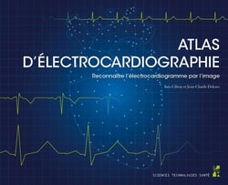 Atlas d'électrocardiographie : Reconnaître l'électrocardiogramme par l'image