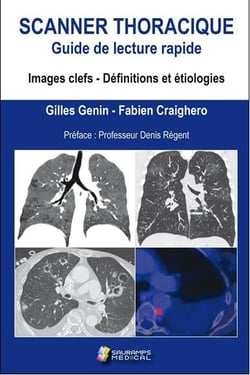 Scanner thoracique, guide de lecture rapide - images clefs, définitions et étiologies