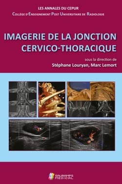 Imagerie de la jonction cervico-thoracique - les annales du CEPUR