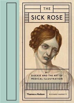 The sick rose disease and the art of medical illustration