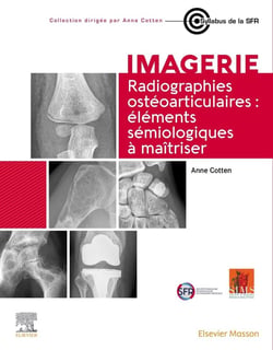Imagerie : radiographies ostéoarticulaires : éléments sémiologiques à maîtriser