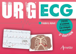 URG' : ECG : 210 ECG et schémas, cas cliniques et corrections (2e édition)