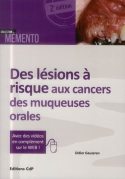 Des lésions à risque aux cancers des muqueuses orales