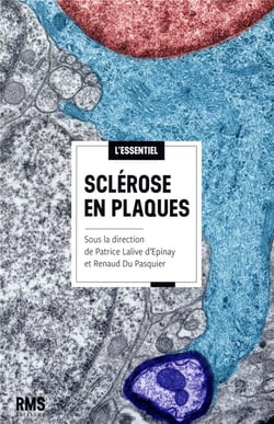 Sclérose en plaques