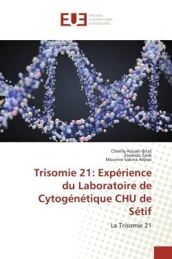 Trisomie 21: Expérience du Laboratoire de Cytogénétique CHU de Sétif : La Trisomie 21