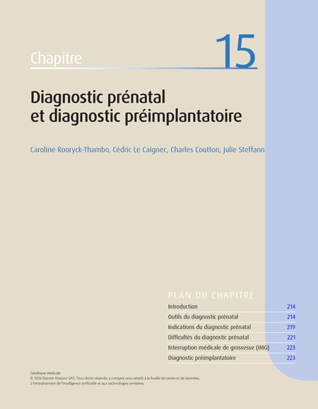 media/pim/13023927_21cukk55_3_cc815