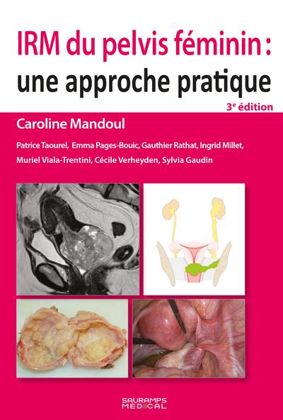 IRM du pelvis féminin : Une approche pratique (3e édition)