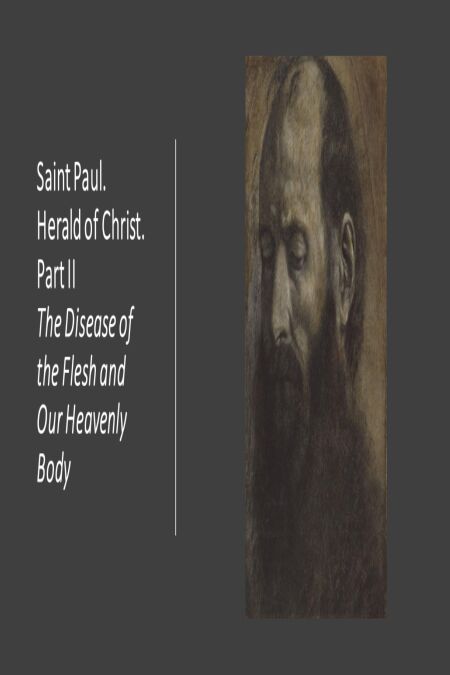 media/pim/24_06c09368-ff21-4256-a540-e0c8d7470d5d.jpeg