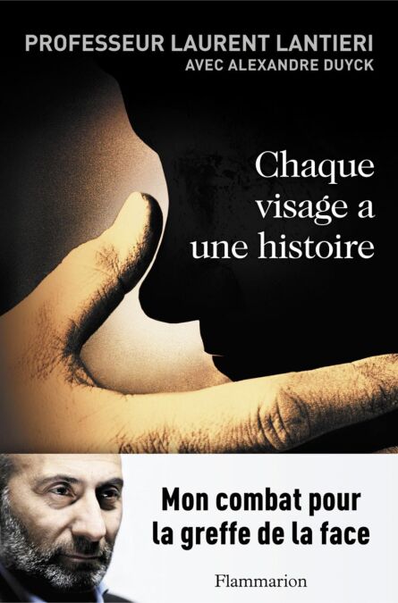 media/pim/4_be7f903d-5b70-472d-95fb-b49e3a81f0fa.jpeg