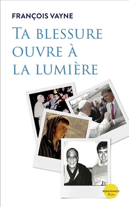 media/pim/5_metadata-image-56405859.jpeg