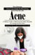 Acne: The Ultimate Acne Cure Guide for Becoming Acne Free for Life (A Holistic Guide to Balancing Your Body Naturally for Lasting Acne-free Skin)