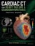 Cardiac CT for Heart Failure & Cardiomyopathies: Practical Insights - Medical Series