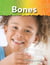Bones